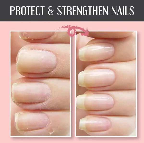 Repairing and Protecting Nail Gel: Strengthens and Regenerates