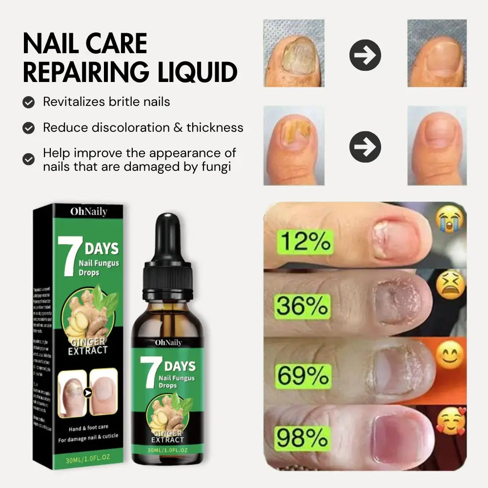 Nail Treatement - Natural antifungal care